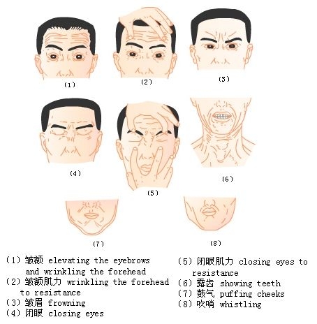 额纹消失是什么面瘫图片