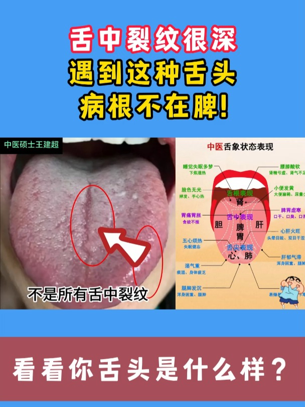 舌头分叉是什么原因图片