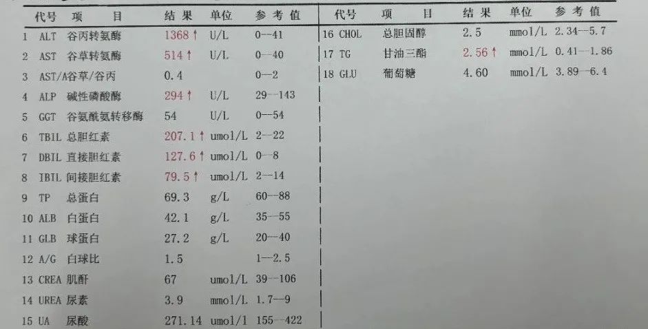 这是昨天下午一位乙肝大三阳患者的转氨酶的指标,1000多确实很高