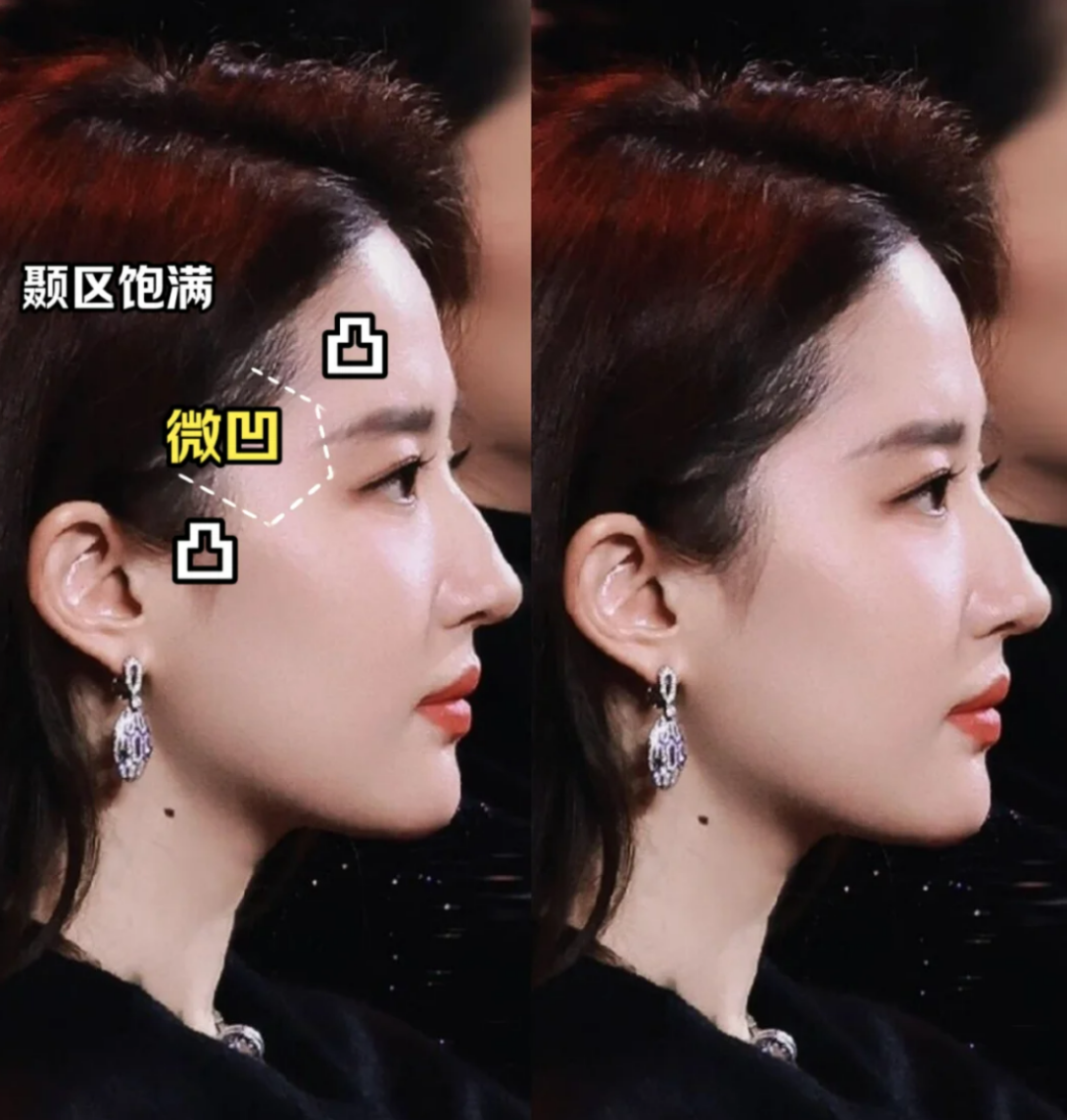 真没人说吗？太阳穴就是微凹才好看啊！为什么这么说呢？