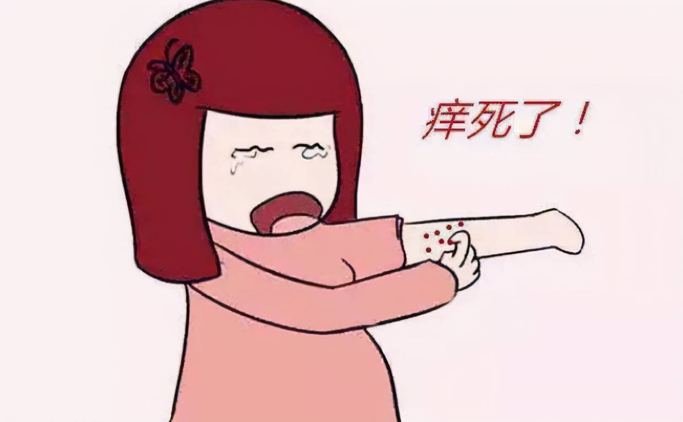 为什么会有体癣?如何预防体癣?