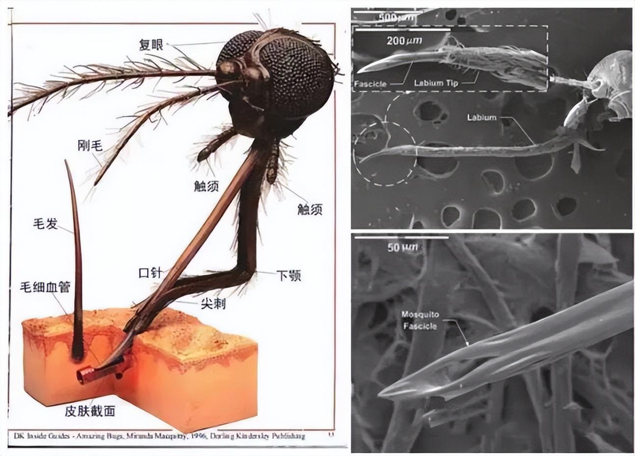 回顾:为何我们不制造像蚊子口器那样的针头?那打针岂不是不痛了?