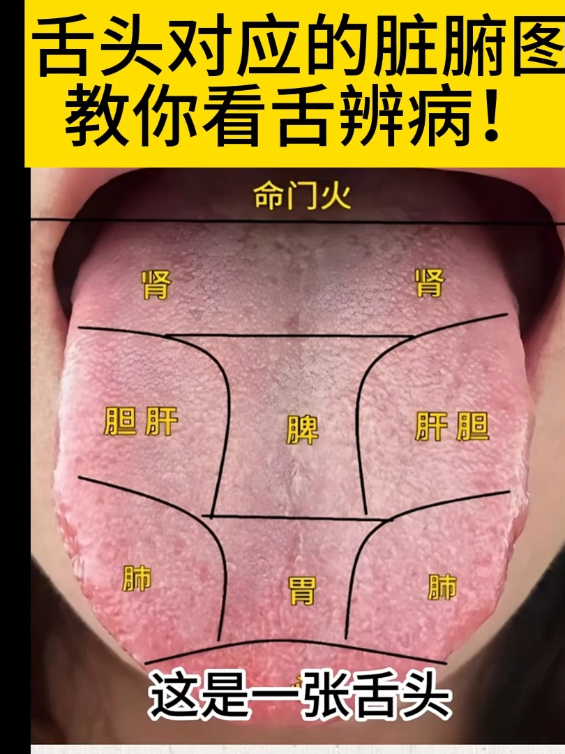 这是一张舌头对应的脏腑图,教你看舌辨病!