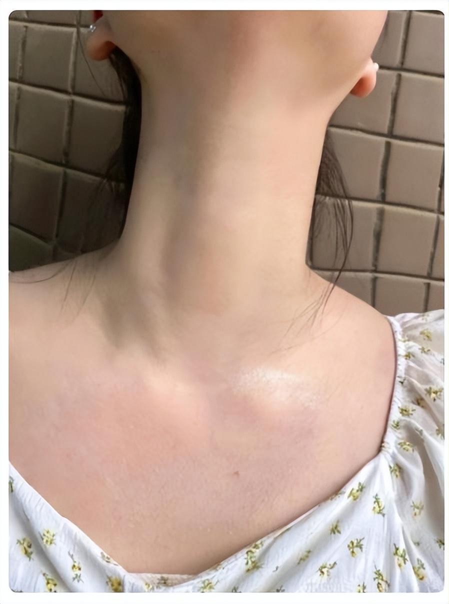 女人脖子上出现这3条杠,用粉底液遮盖也不管用?教你轻松减龄