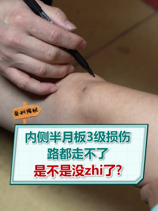 内侧半月板3级损伤,路都走不了,是不是没治了?