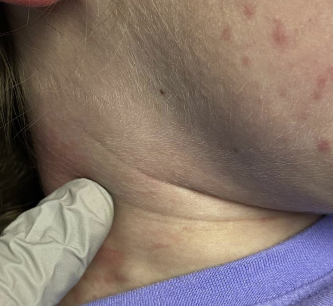 危险的肿块不会喊"疼"!2个部位出现肿块,或是癌症的"信号"