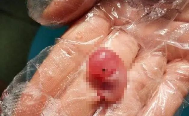 60天的胎儿流产出来的模样,看完让人揪心,网友:不忍心看!