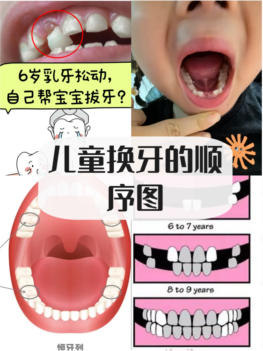 小朋友换牙齿的顺序图
