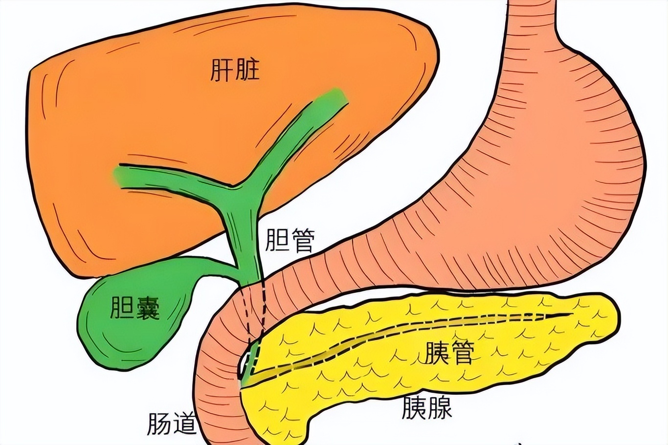 用好这张古方,化胆结石,胆囊炎,胆息肉很强势!