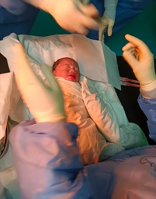 2011年,四川女子生下中国首例"双头婴儿",之后怎么样了