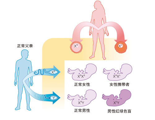 脸盲症患者眼中的世界图片