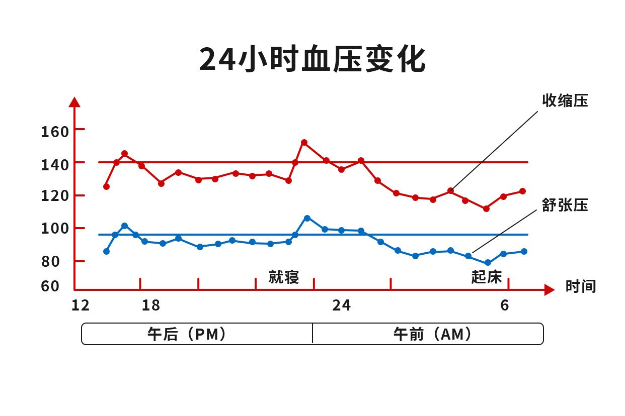 正常人血压脉搏曲线图图片