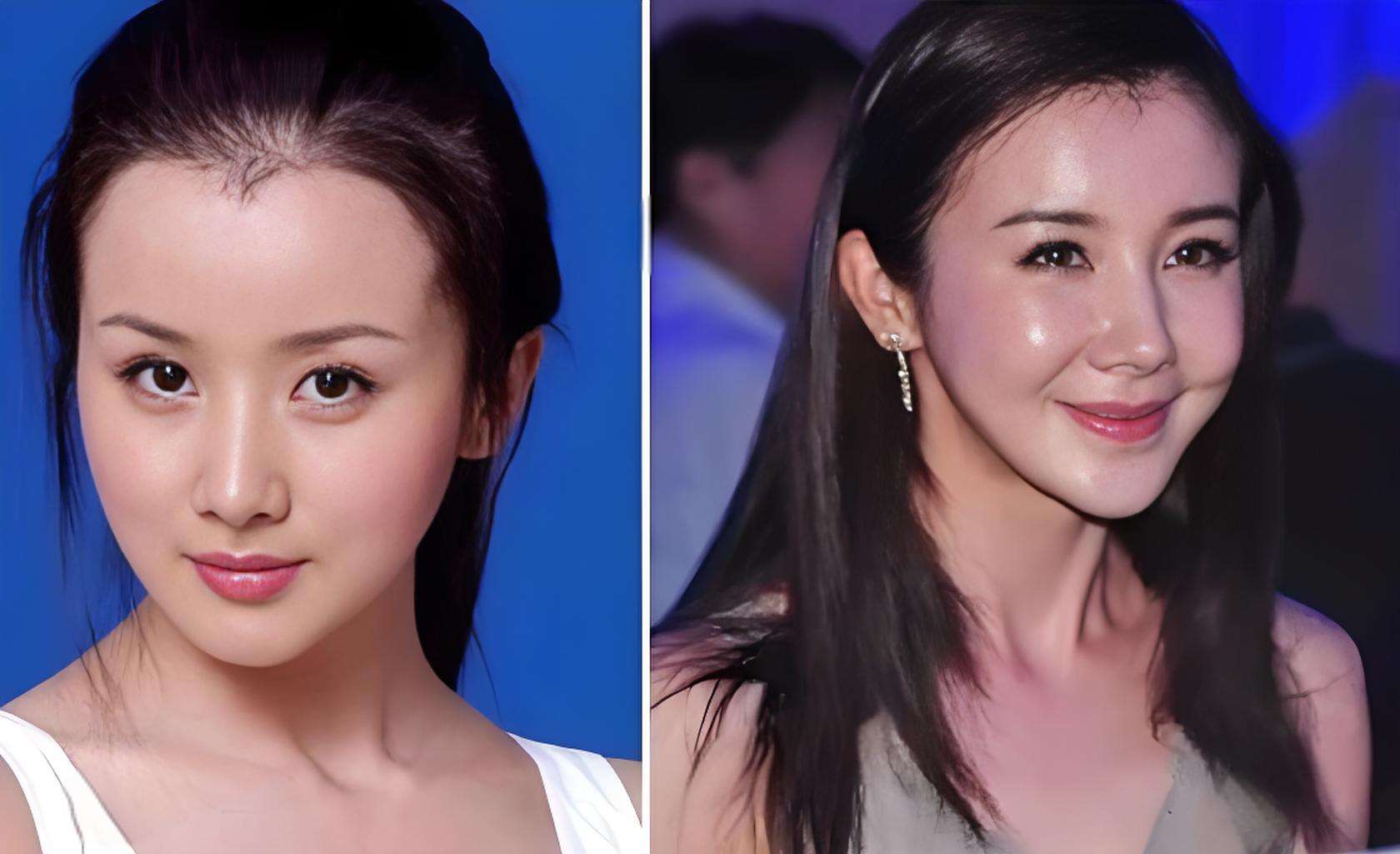 青春赌局输得惨!8位明星整容后颜值崩塌