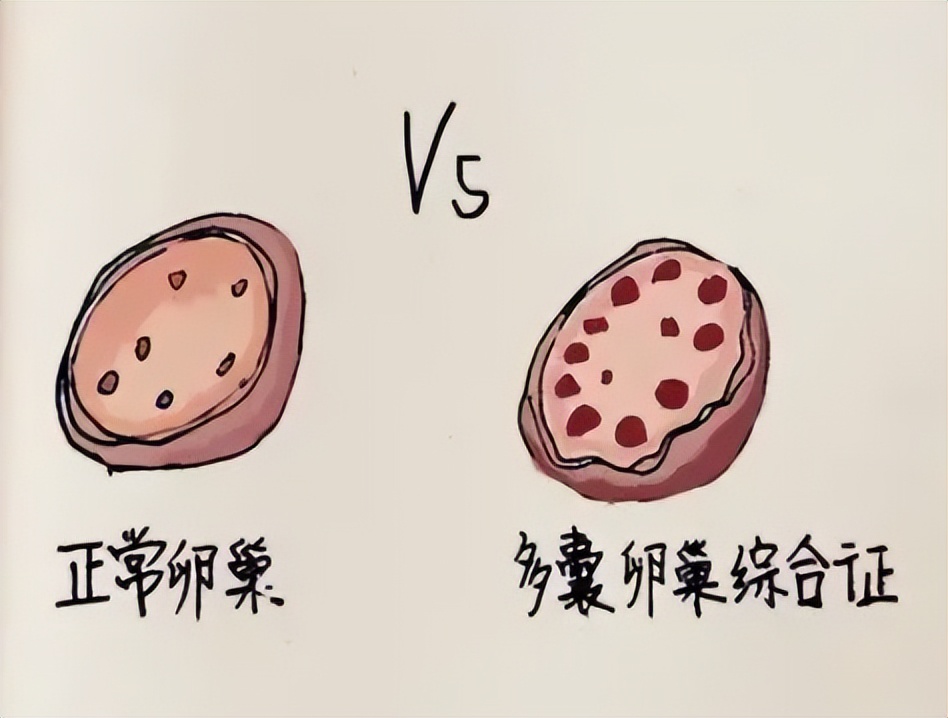 双侧卵巢取卵后改变(双侧卵巢取卵后改变怎么办)