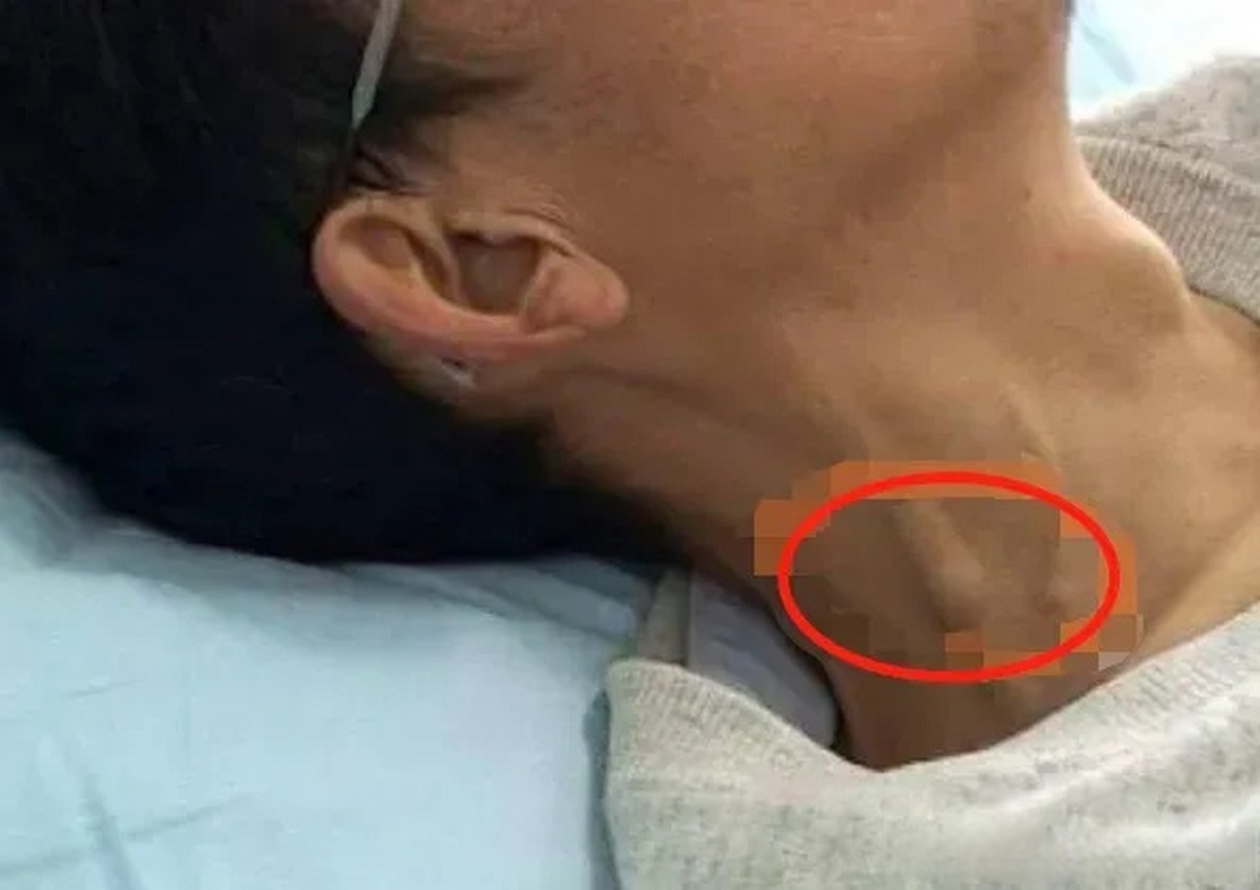 颈动脉死亡痛苦吗