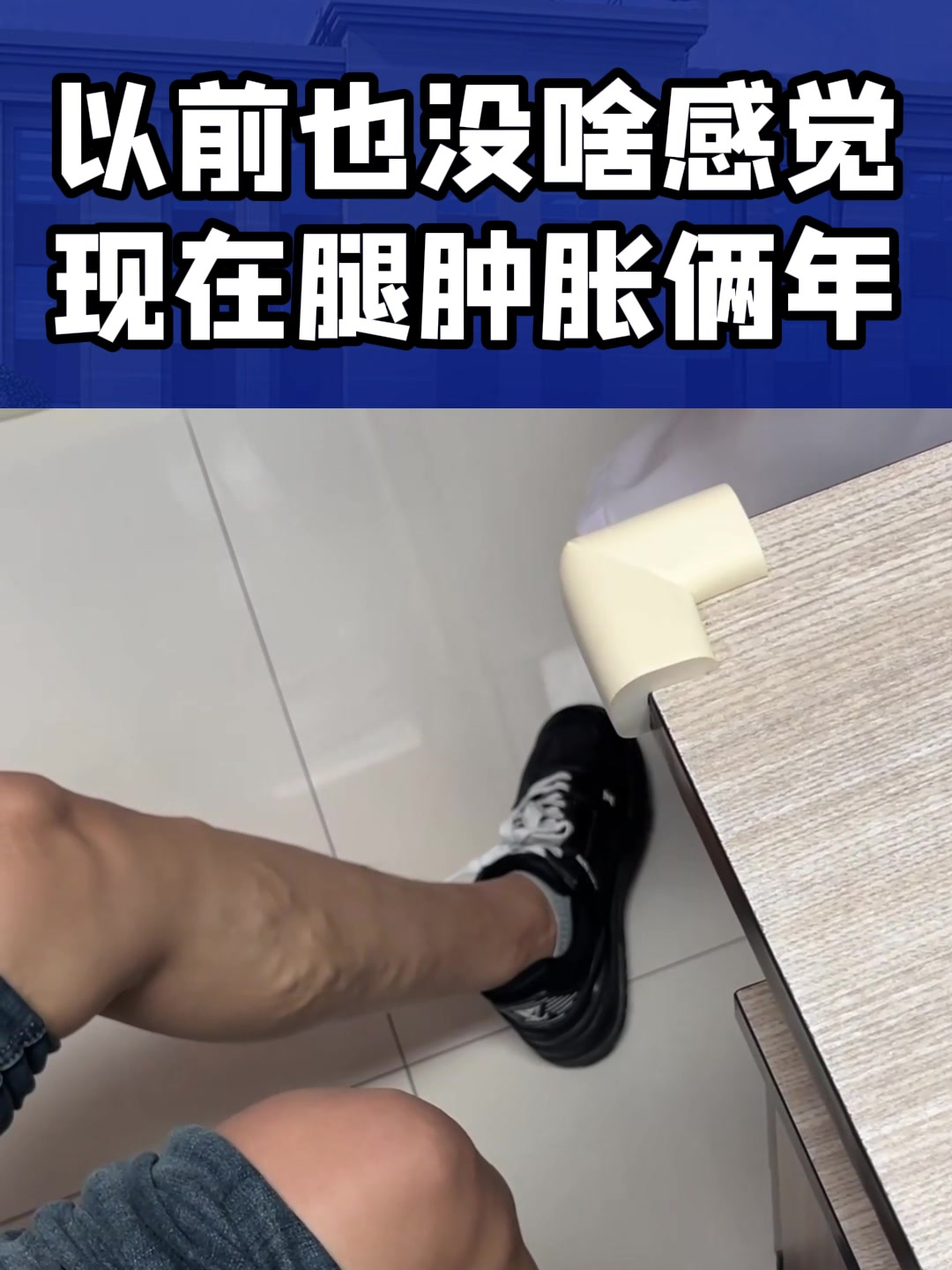 以前也没啥感觉,现在腿肿两年了