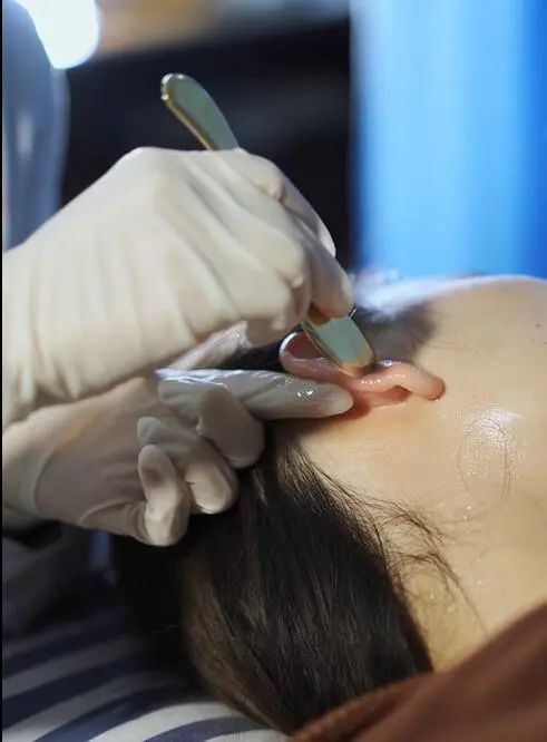 苦苦治疗失眠无果?耳部全息刮痧还你一个美容觉