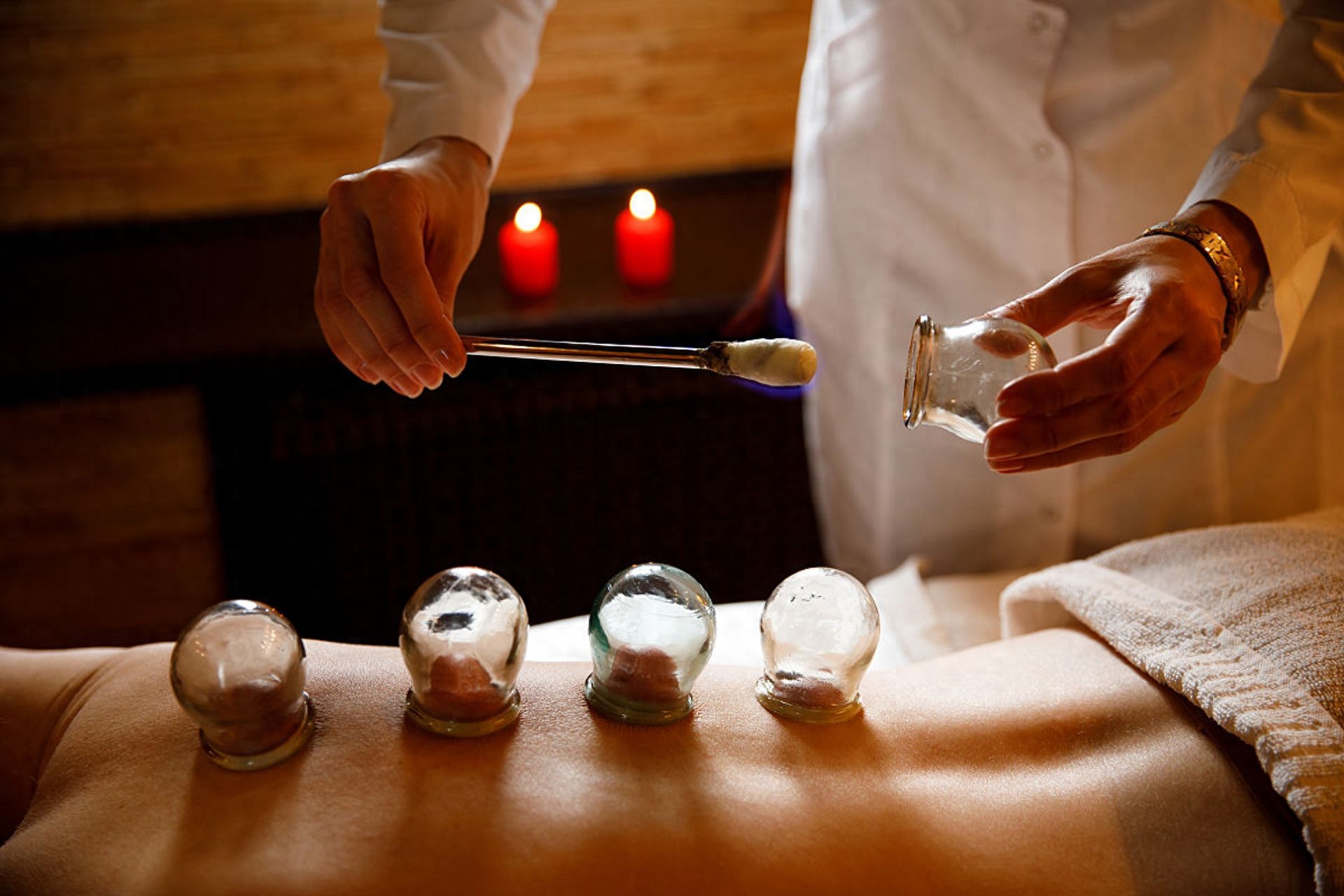 拔火罐吸出来的瘀血,是身体排出的毒素?告诉你真相,看完涨知识