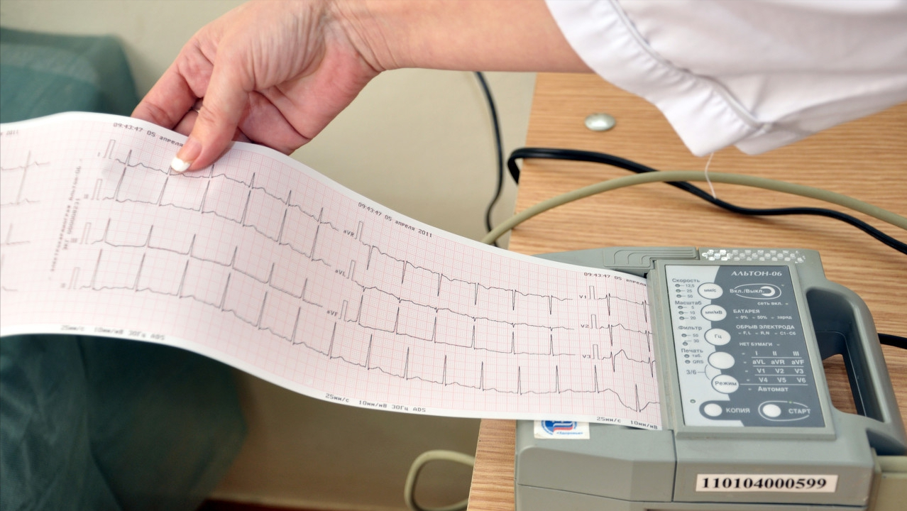 体检时,医生让做心电图,这个检查有必要吗?