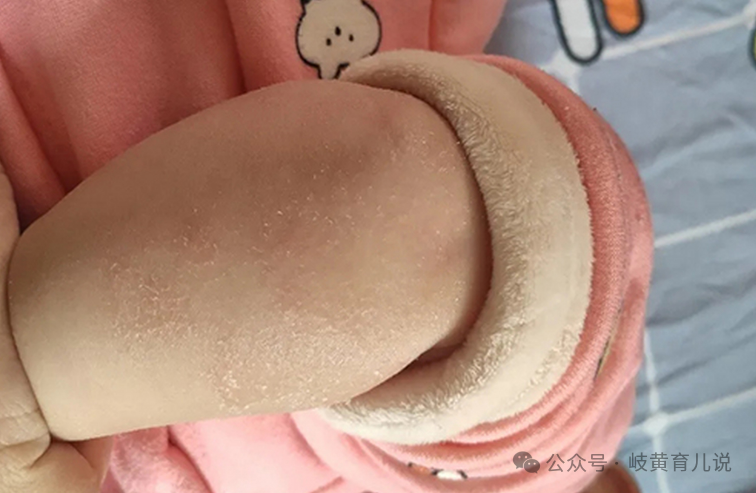 冬天气候比较干燥,家里的暖气,也会加重燥气,外界