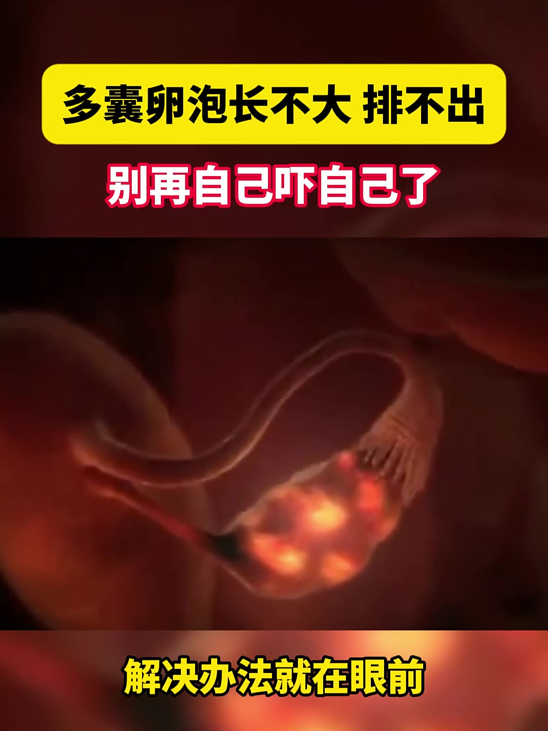 卵泡到多大会排(卵泡一般多大会排卵)