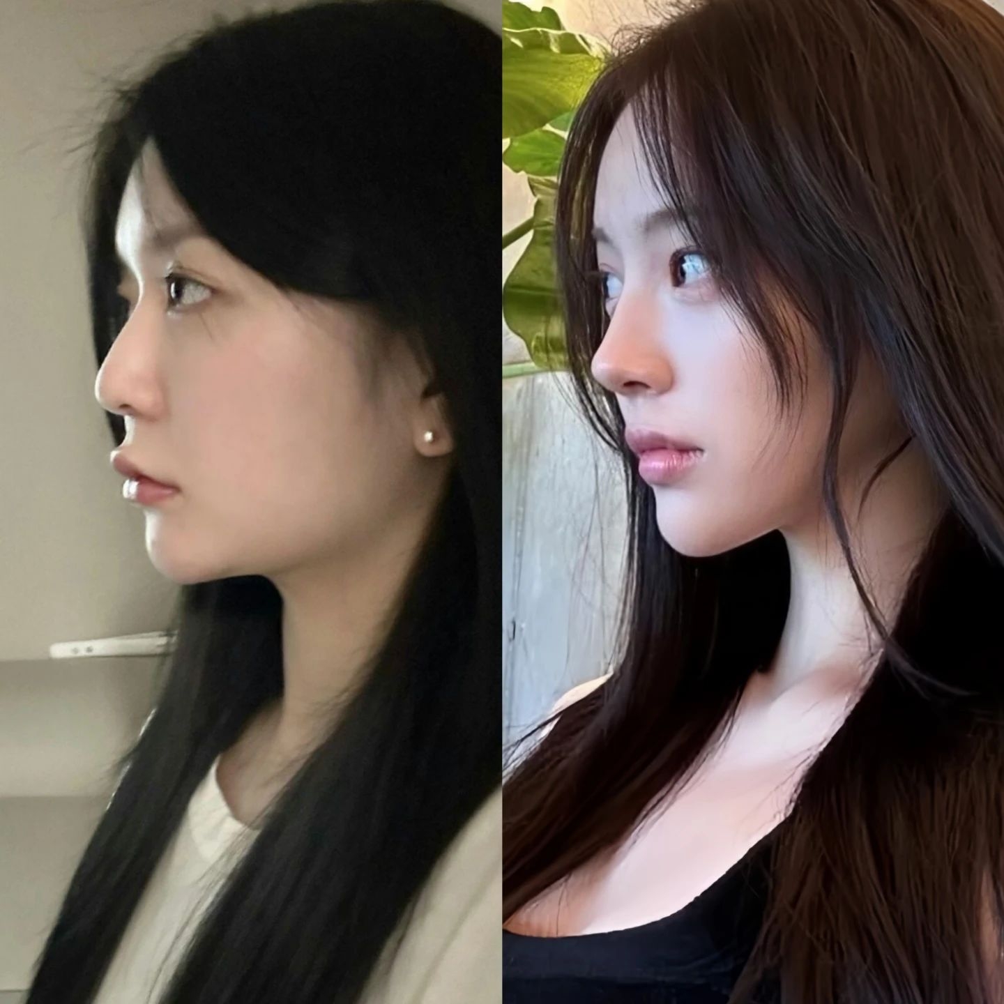 盘点成都磨骨(改脸型)医生top有哪些?