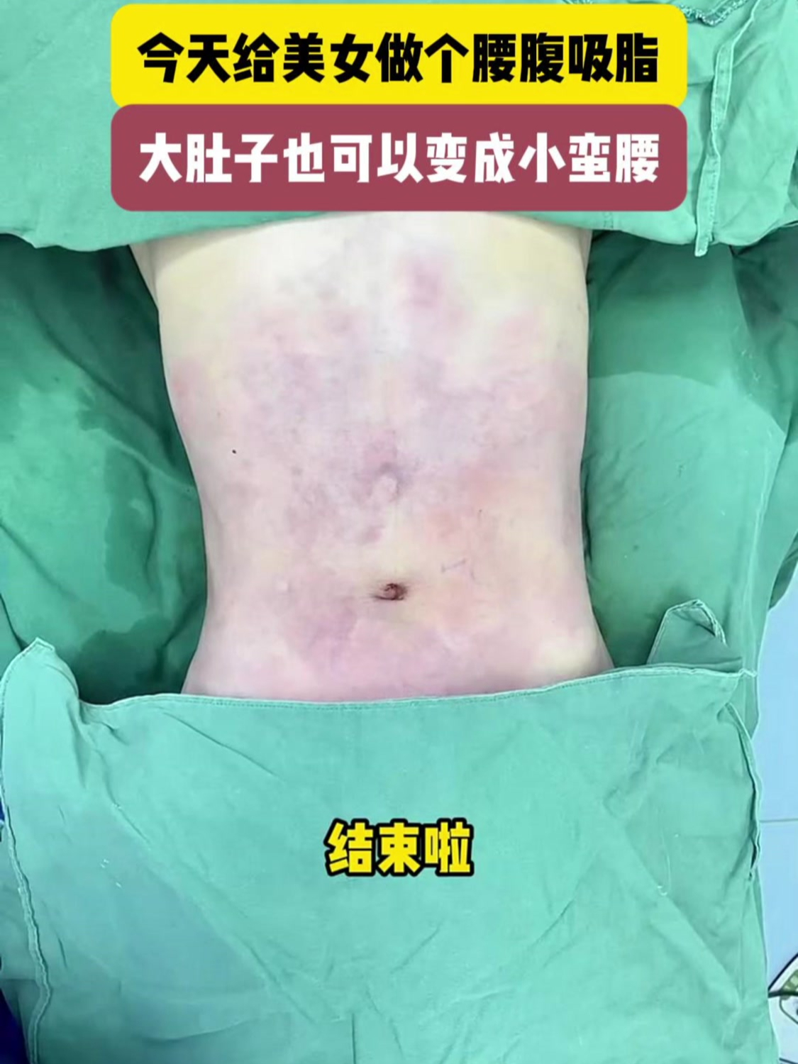 女生小蛮腰 大肚子图片