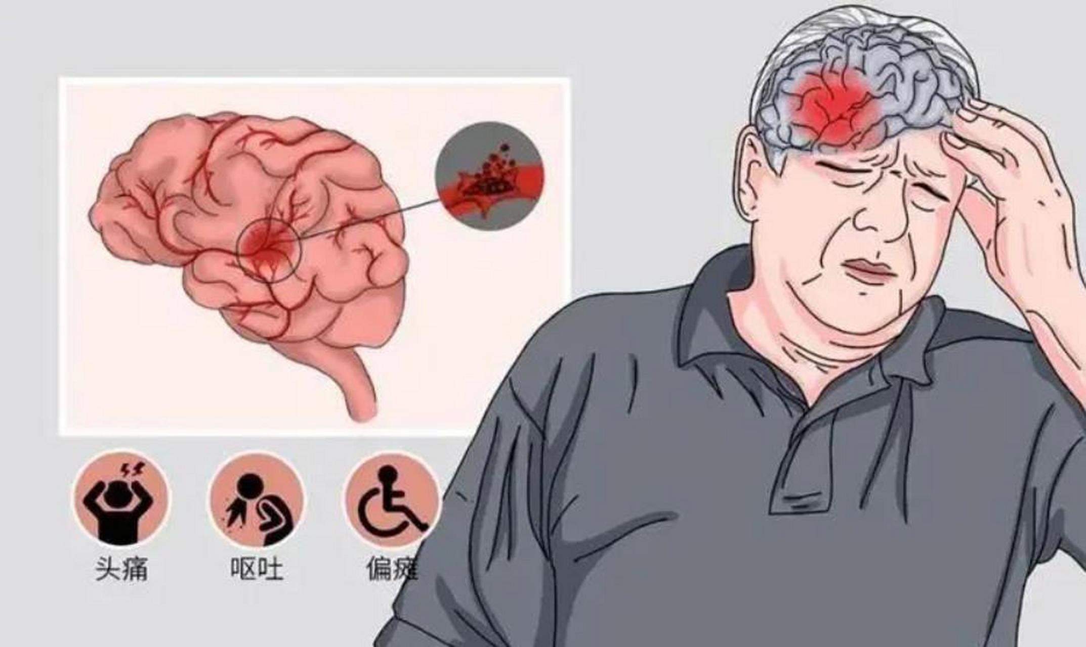 耳朵出现这些症状需警惕!或许是脑梗在提醒,别不当回事!