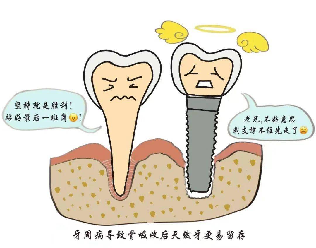 种植牙能使用多久?如何维护其长久健康?