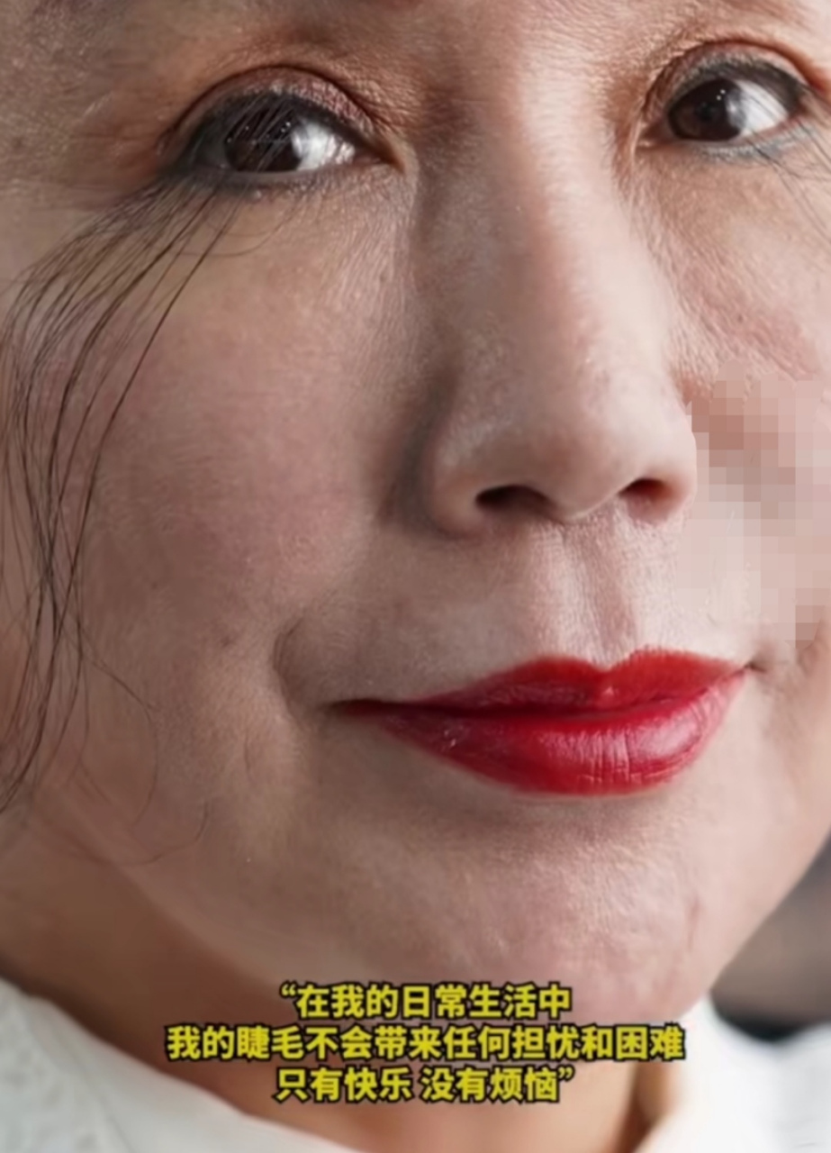 吉尼斯纪录,世界上最长的眼睫毛拥有者,两眼中左眼最长睫毛达20.