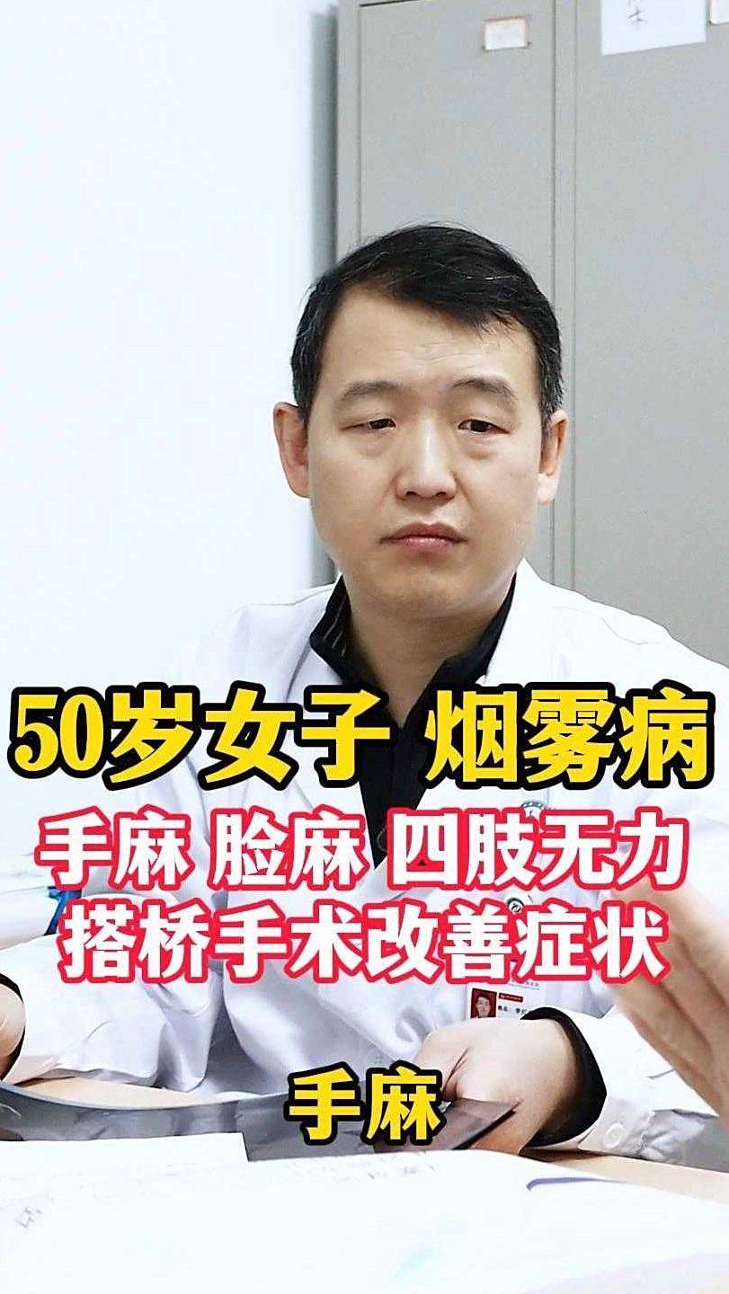 面部感觉麻麻的是怎么了百科在线