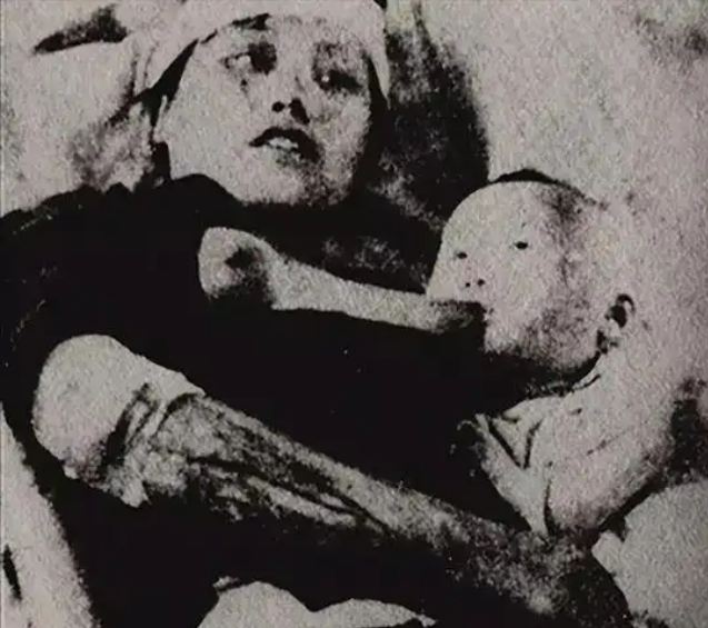 日军731部队哈尔滨噩梦:活体解剖与婴幼儿实验的真相