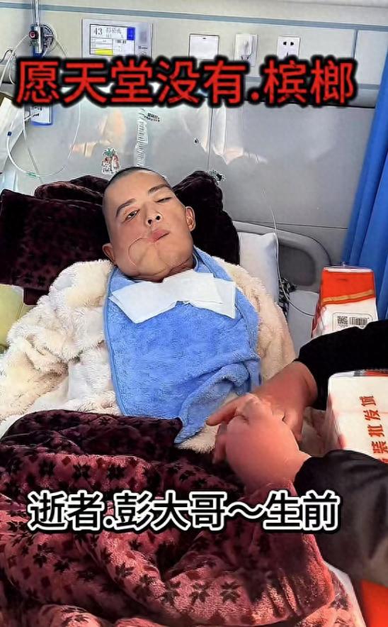 47岁抗癌网红"彭大哥"因口腔癌去世,长期嚼槟榔割掉右脸