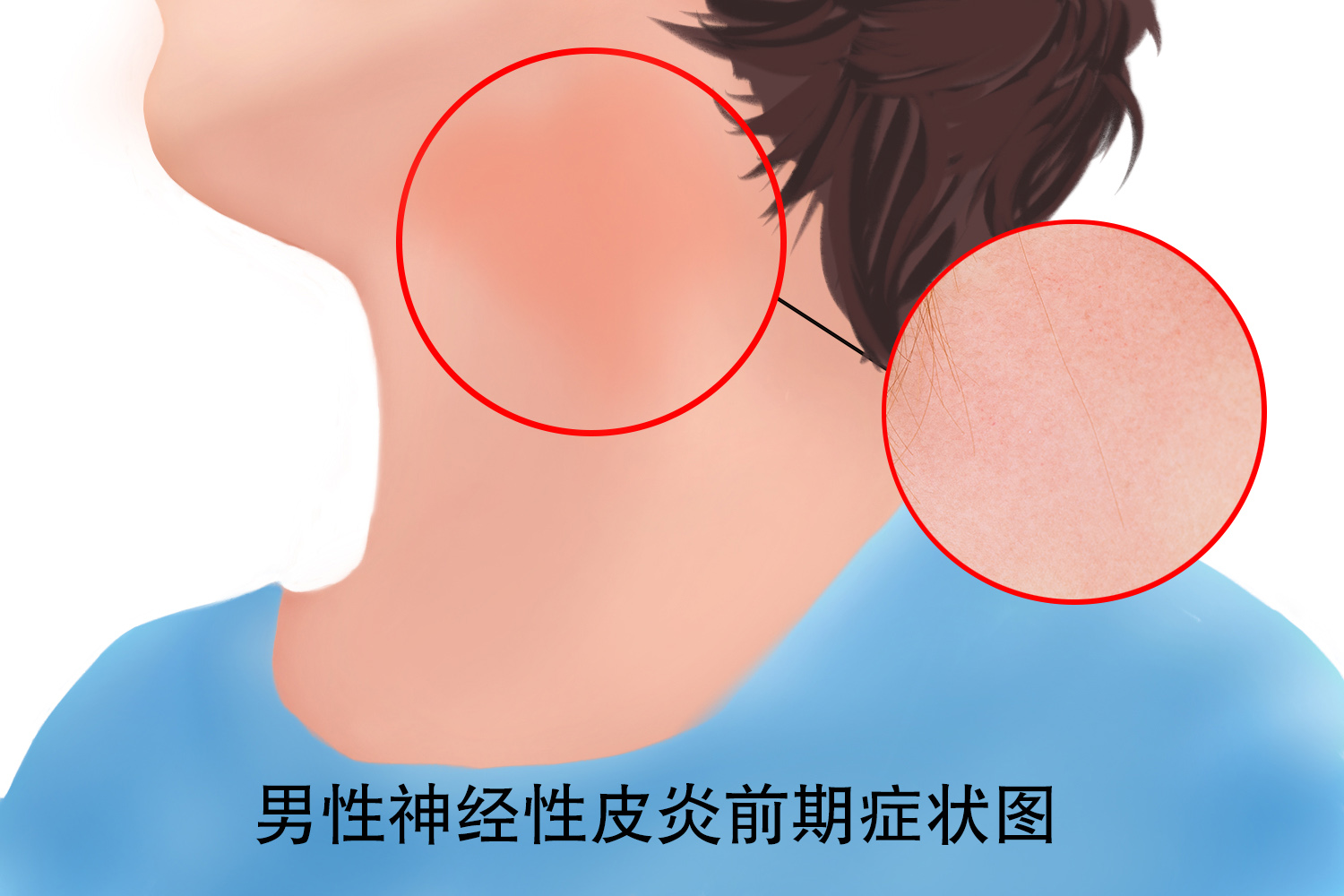 为什么脖子痒