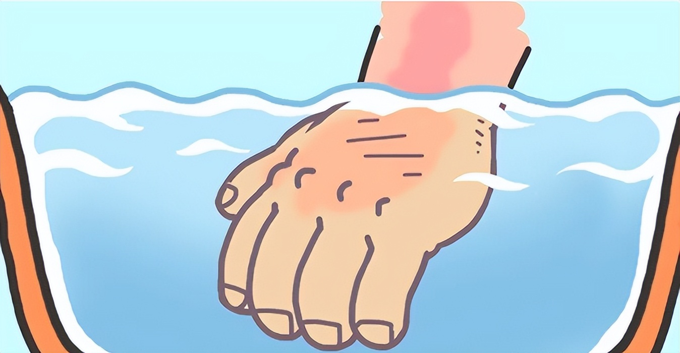 4岁孙女被100°c开水烫伤,奶奶60秒急救处理,医生称赞:很及时