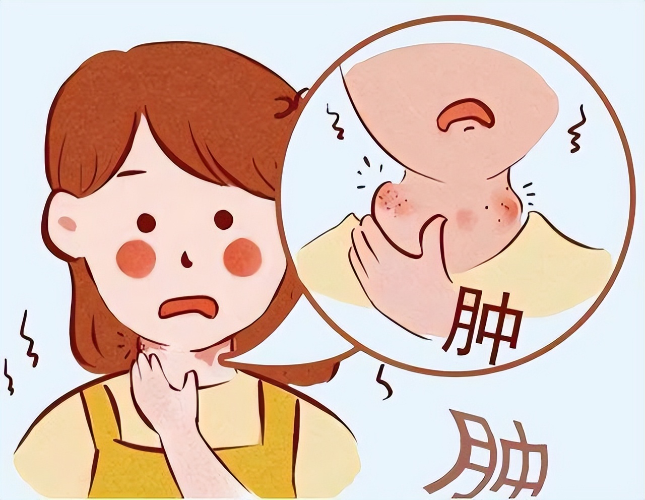 最常见的艾滋病相关肿瘤包括卡波西肉瘤和某些类型的淋巴瘤