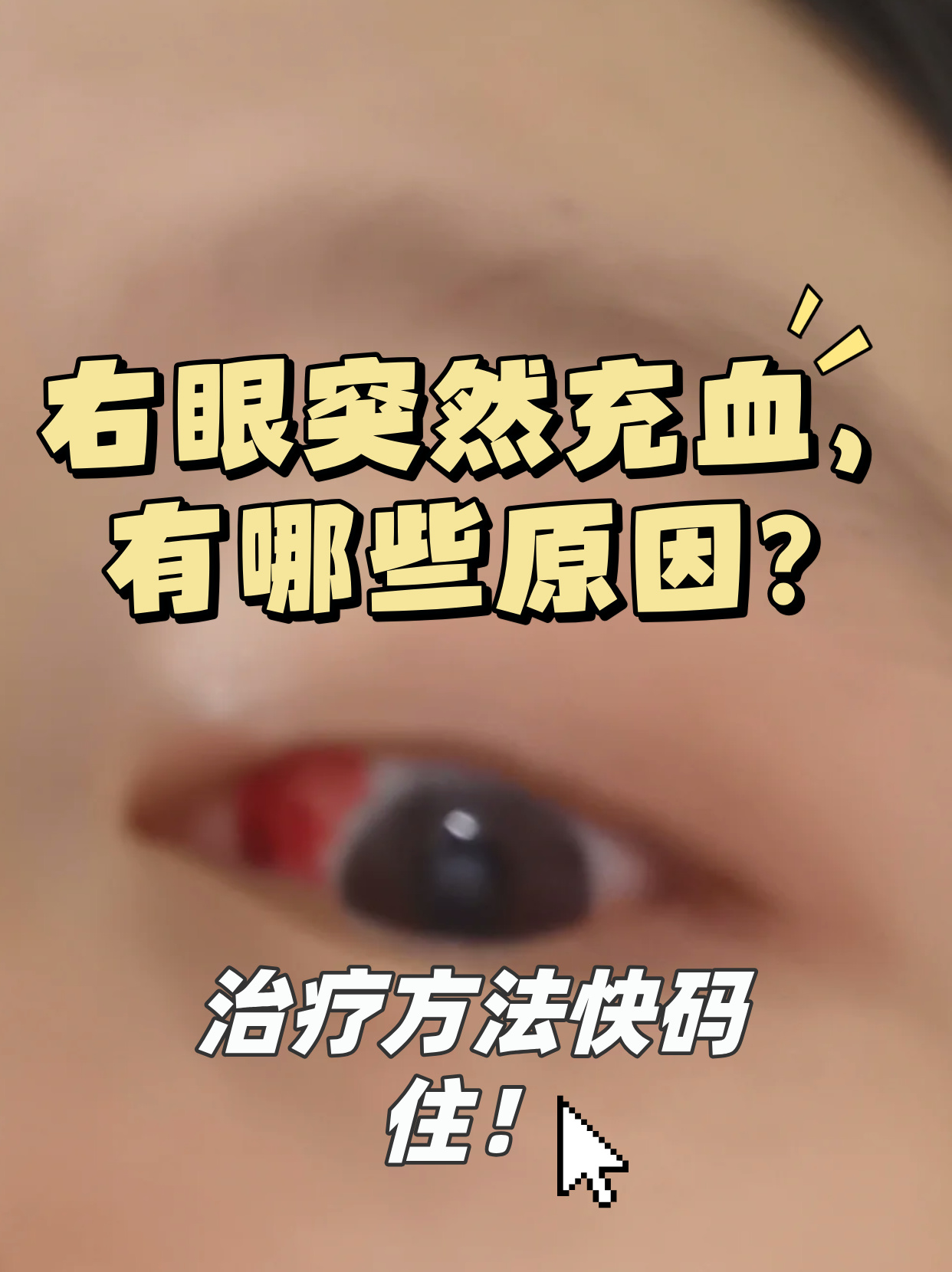 一天,诊室里来了一位焦急的患者,她紧张地指着自己