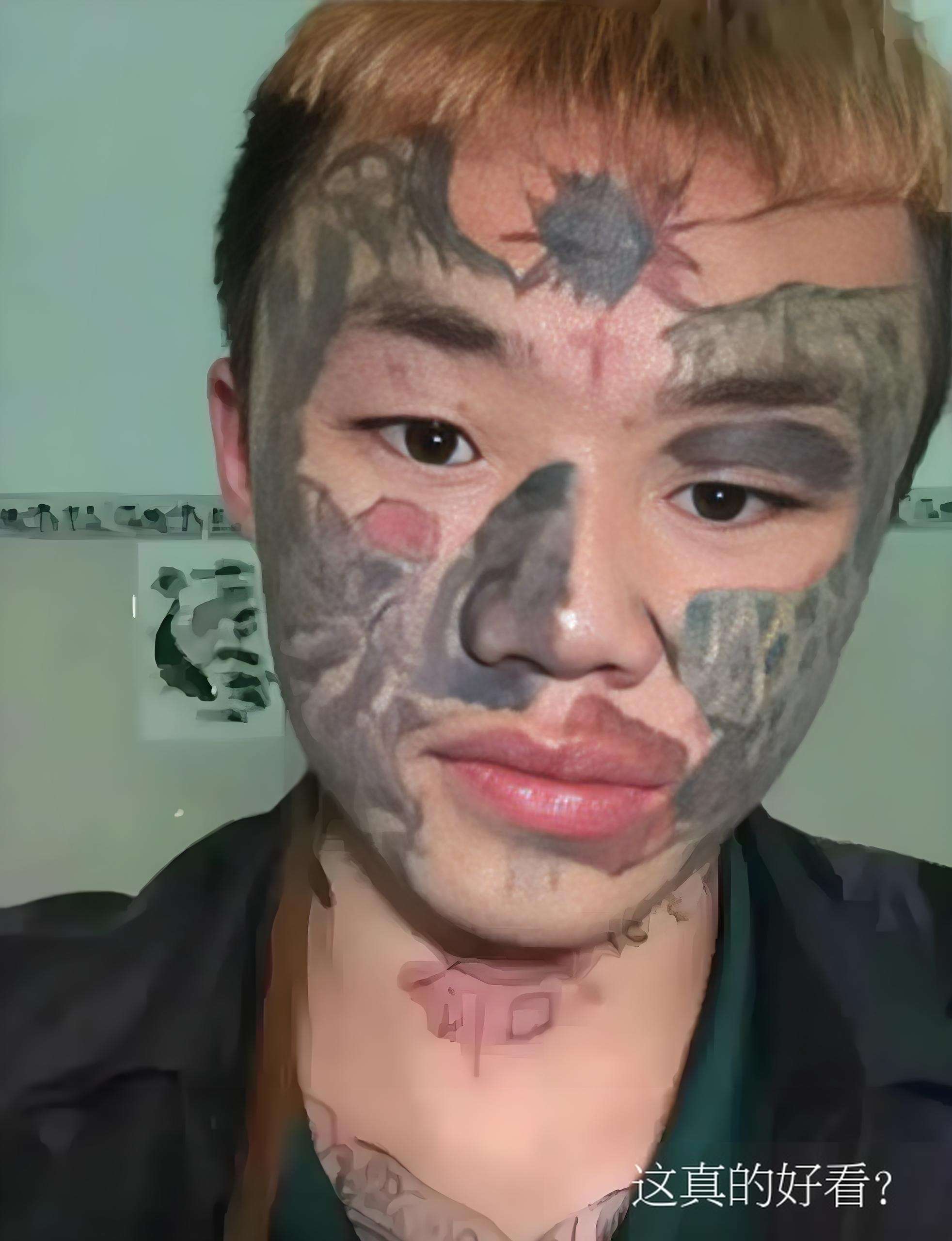 可怜"纹面男孩"悲惨现状:没当成网红,一辈子也彻底毁了