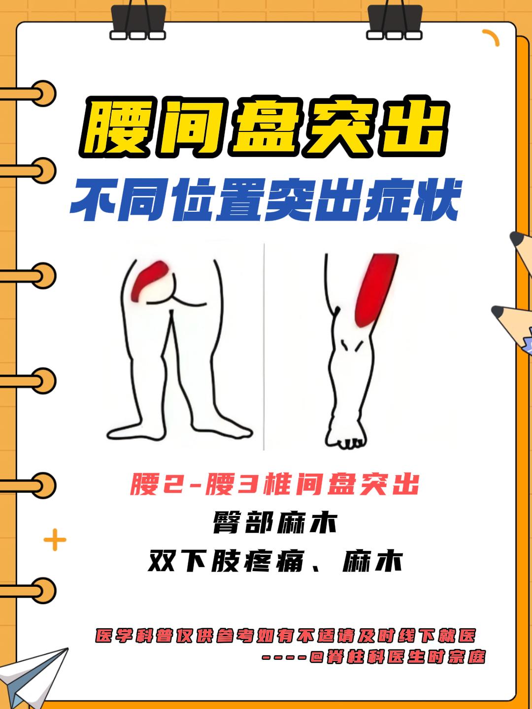 四张图告诉你不同位置突出症状#腰椎间盘突出症##健康##腰间盘突出