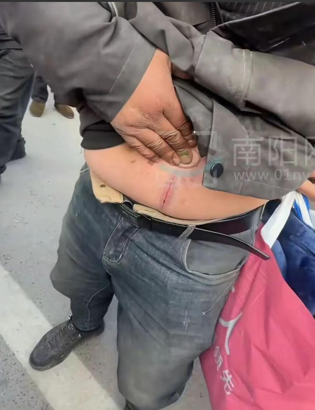 "河南洛阳,卖粉条的大叔勇救13岁落水女孩,肚子却被河里的钉子划伤!