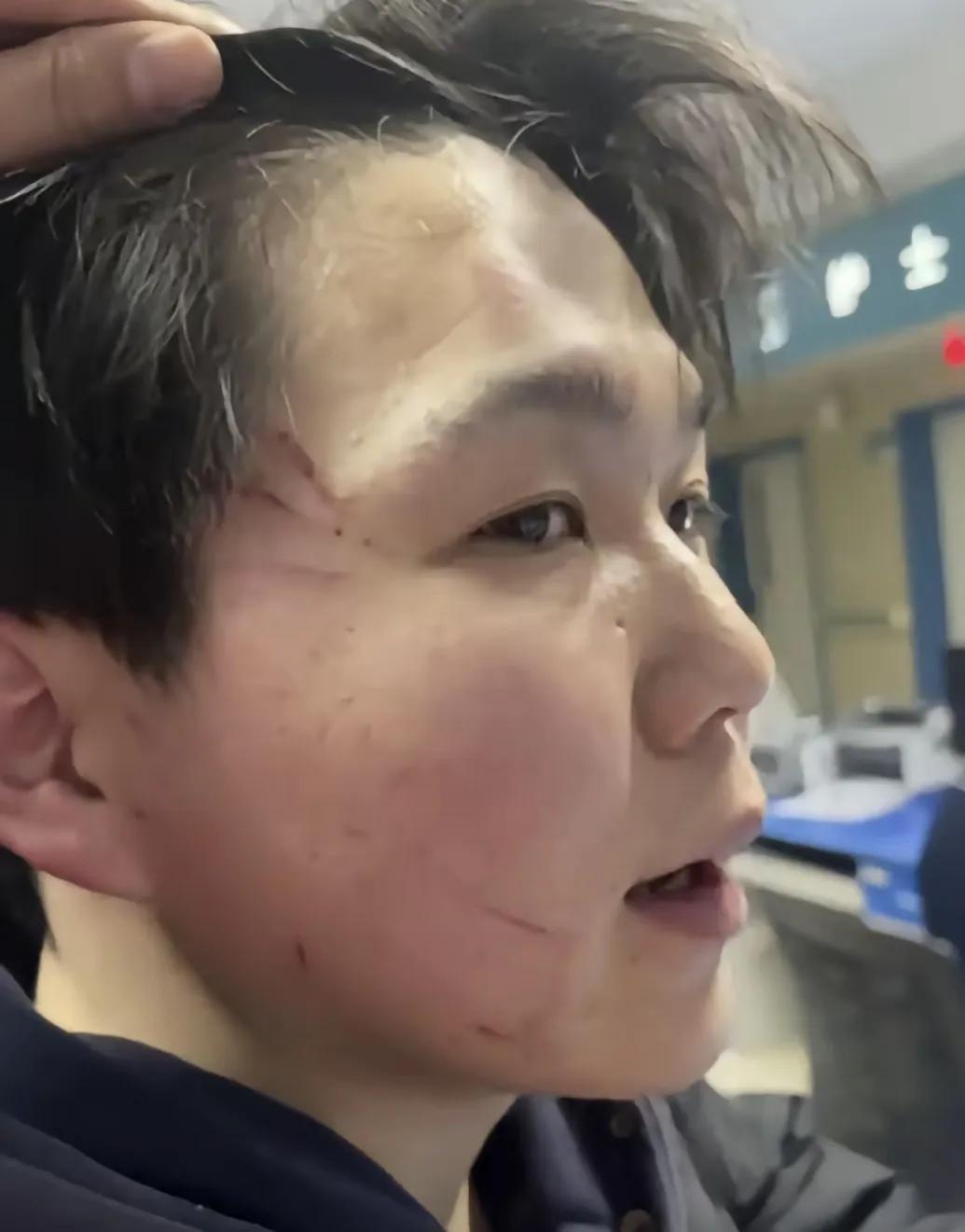 女子新婚半年被丈夫家暴,岳父护女也被殴打,反被网友质疑彩礼高