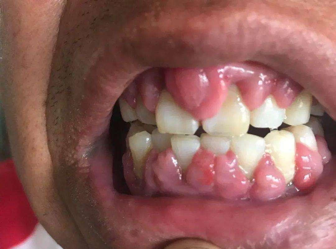 义诊这事儿,别人可能觉得累还不讨好,但我却觉得这