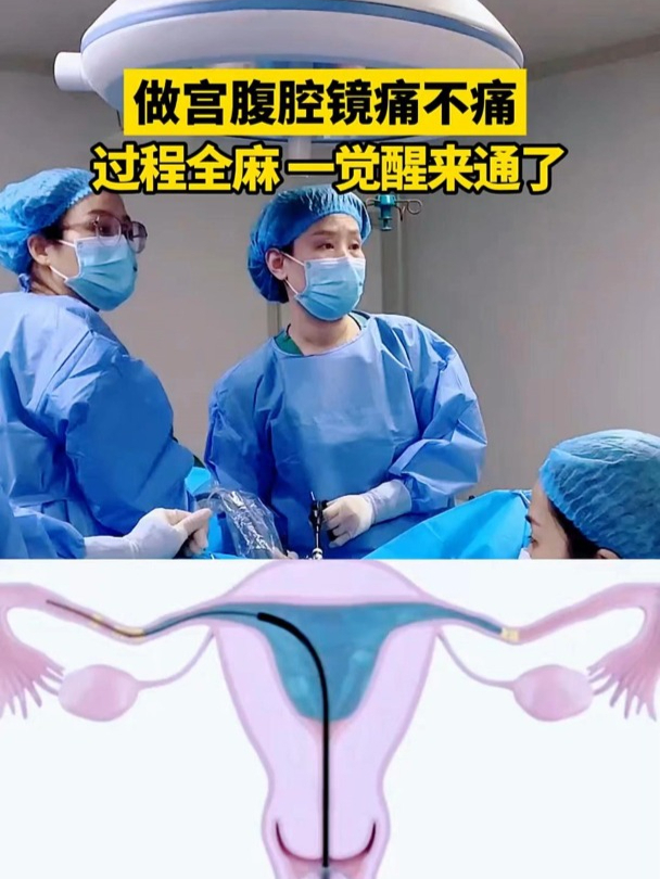 腹腔镜手术尽量别做全麻吗百科在线