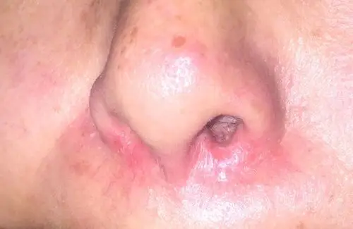 前段时间和老同学聚会,他一坐下就皱着眉抱怨:现在