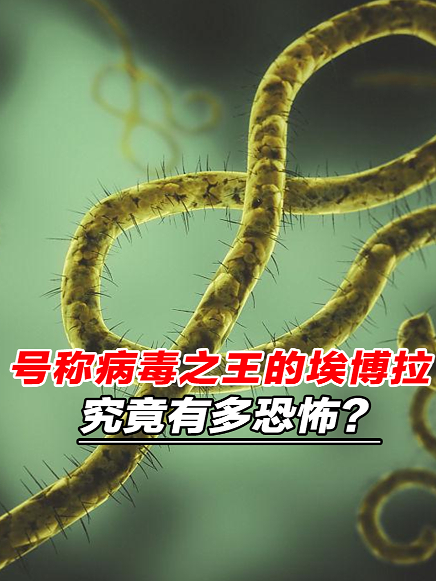  现在又出现什么病毒(近期流行的病毒是什么)