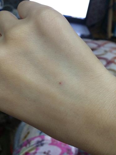 一个"针眼"的故事