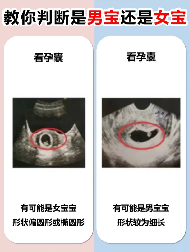 教你判断是男宝还是女宝