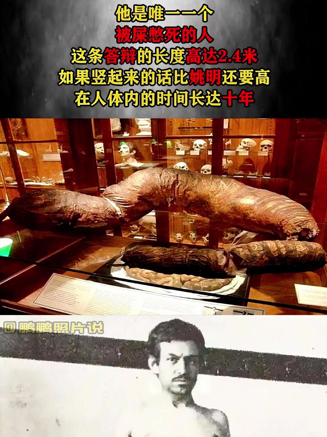 世界上唯一一个被屎憋死的人