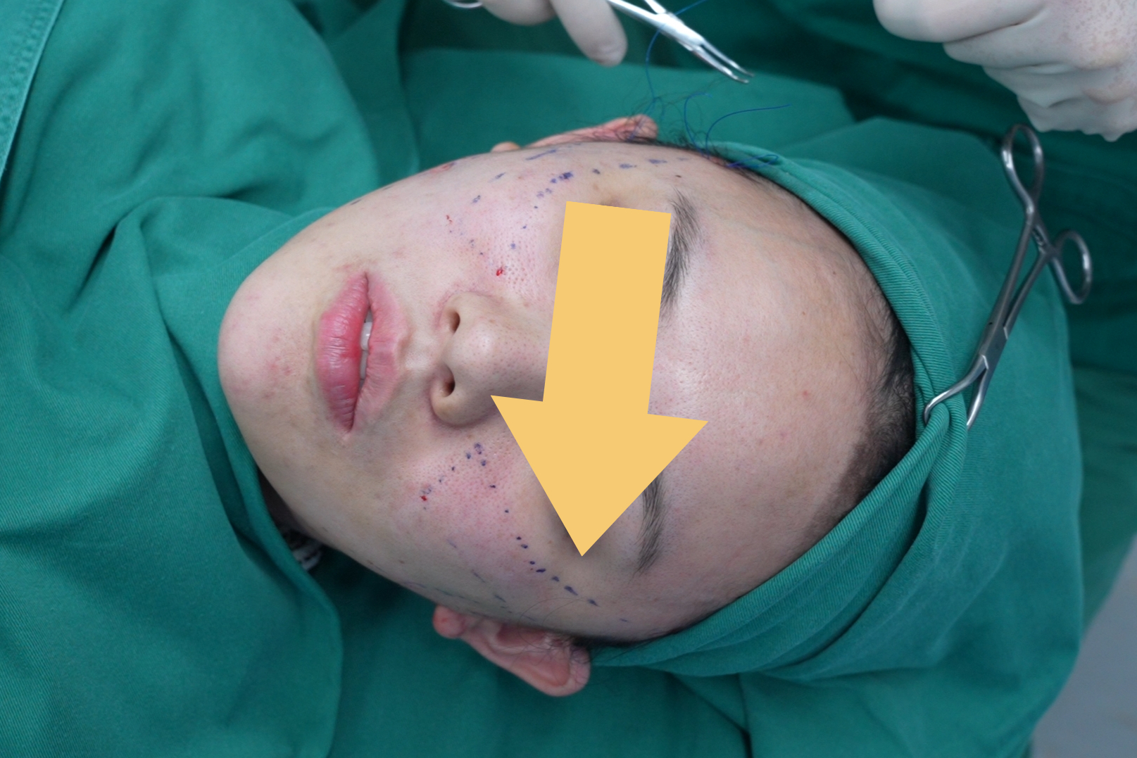 常常能听到我们的护士医助说,这么多手术