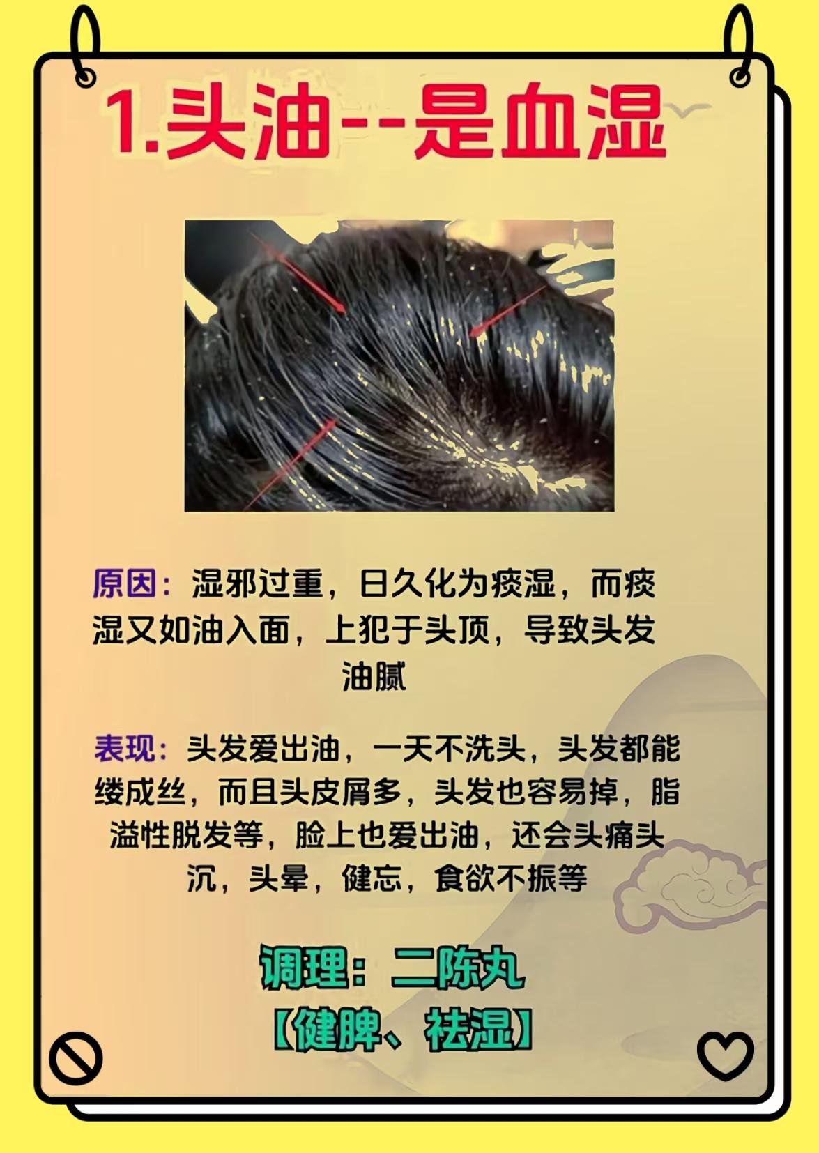 头油一是血湿头痒一是血热脱发一是血虚三个中成药还你一头乌发